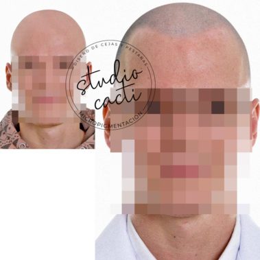 Micropigmentacion capilar Valencia