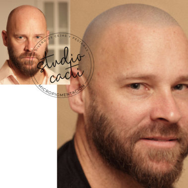 Micropigmentacion capilar Valencia