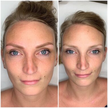 Micropigmentación, mujer antes y después