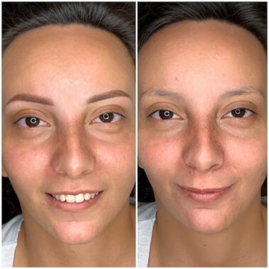 Micropigmentación, mujer antes y después
