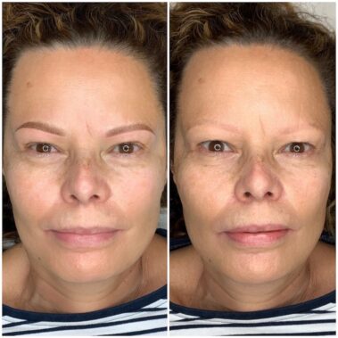 Micropigmentación, mujer antes y después