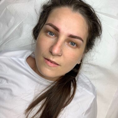 Micropigmentación, mujer antes y después