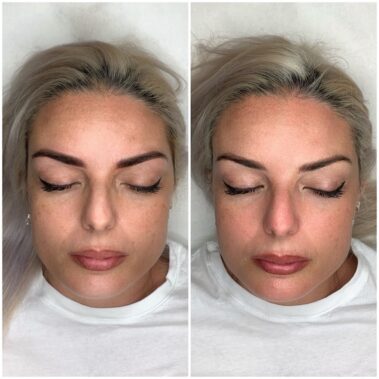 Micropigmentación, mujer antes y después