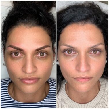 Micropigmentación, mujer antes y después