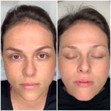 Micropigmentación, mujer antes y después