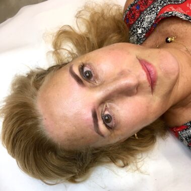 Micropigmentación, mujer antes y después