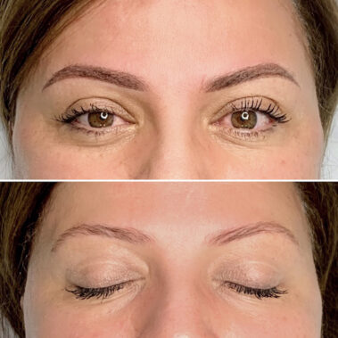 Micropigmentación, mujer antes y después