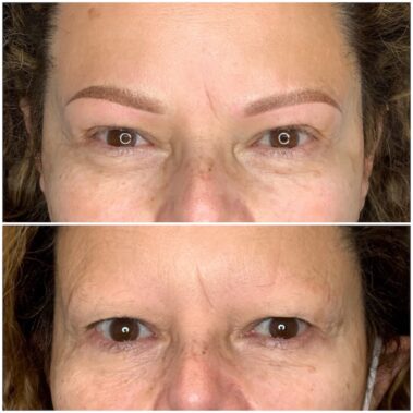 Micropigmentación, mujer antes y después