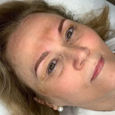 Micropigmentación, mujer antes y después