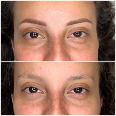 Micropigmentación, mujer antes y después